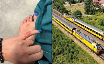 FOTO: Cesta na východ sa pre český pár neskončila šťastne. Vo vlaku ich dohrýzli ploštice